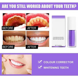 🔥LAST DAY 70% OFF🔥Teeth Colour Corrector Serum