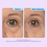 🔥 Instant Lift Eye Gel for Puffiness, Bags & Dark Circles