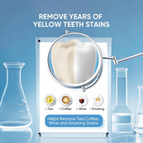 ✨Buy 2 Free 1 & ✨ 🦷 Niacinamide Whitening Toothpaste - For Healthier, Whiter Teeth!