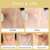 ✨LAST DAY ONLY Buy 1 Get 1 FREE🌸 Firming Neck & Body Cream for Crepey Skin
